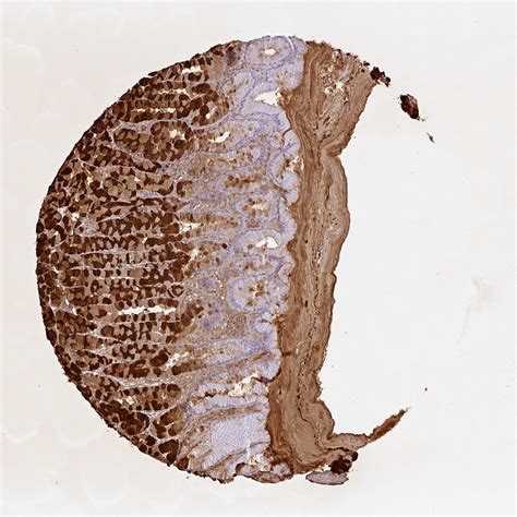 Tissue Expression Of Pga Staining In Stomach The Human Protein Atlas