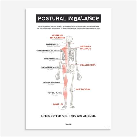 SPINAL NERVE CHART Poster By Kirografiks