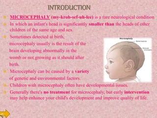 Microcephaly | PPT