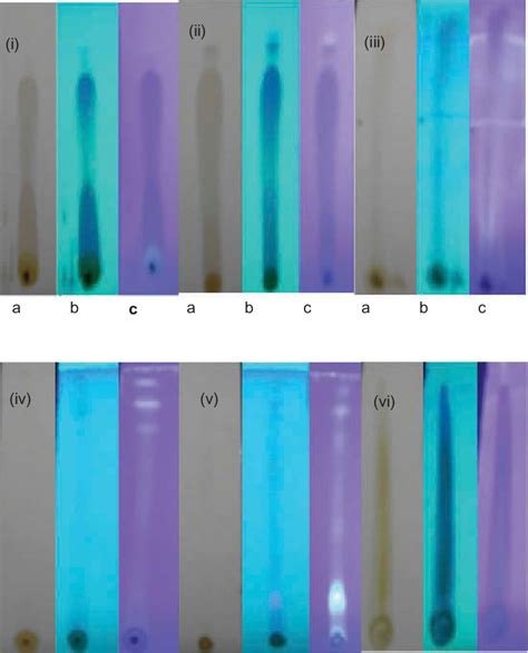 Tlc Plates When Viewed Under A Daylight B Short Uv Wavelength And Download Scientific