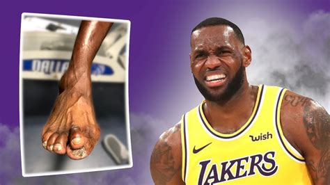 Nba Players Have The Nastiest Feet