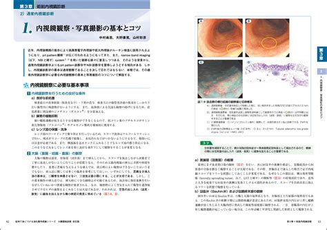 症例で身につける消化器内視鏡シリーズ：大腸腫瘍診断 改訂版〜豊富な写真で上がる診断力、case Studyで磨く実践力 羊土社