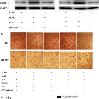 AR Suppresses The Formation Of HCC VM By Inhibiting Expression Of