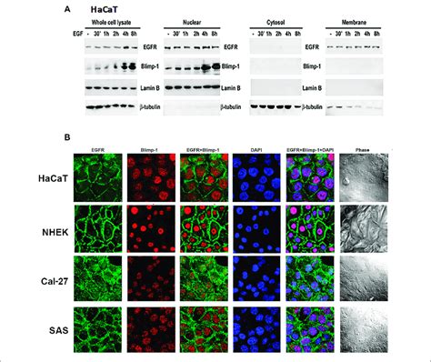 Intracellular Localization Of Blimp 1 In Keratinocytes And SCC A