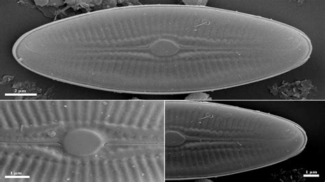 Tiny But Mighty Newly Discovered Diatom From Meghalayas Cave Puts The