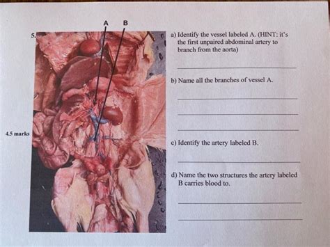 Solved B A Identify The Vessel Labeled A Hint It S Chegg