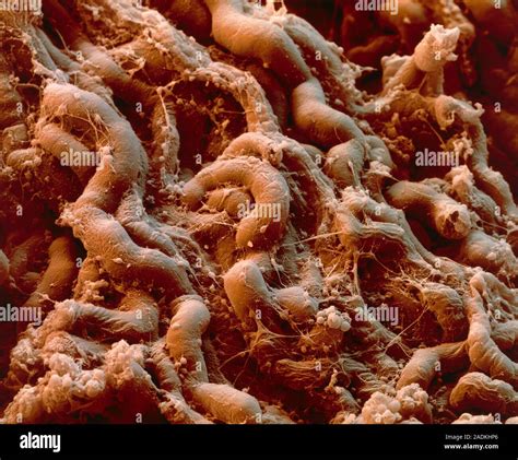 Kidney Tubules Coloured Scanning Electron Micro Graph Sem Of