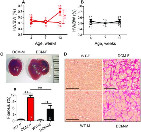 Sex Differences In Cardiac Fibrosis And Hypertrophy In Dcm Mice A