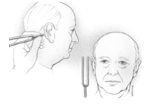 Clinical Techniques The Neurological Assessment A Mixed Course Based