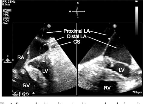 Figure 1 From Usefulness Of Intraoperative Real Time Three Dimensional