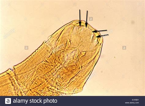 Ancylostoma Duodenale Anatomy