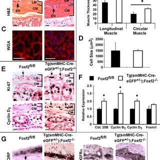 Decreased Foxf And Length Of Intestinal Tract In Tg Smmhc Cre Egfp