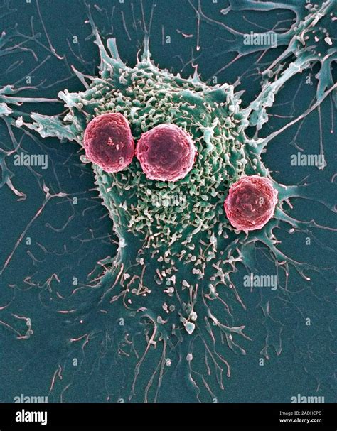 T Lymphocytes And Cancer Cell Coloured Scanning Electron Micrograph