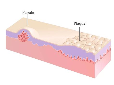 Lesiones Cutáneas Primarias y Secundarias pptx