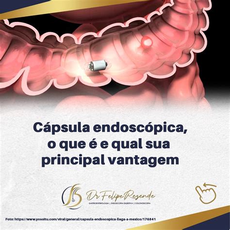 Dr Felipe Rezende Blog Cápsula endoscópica o que é e qual a sua