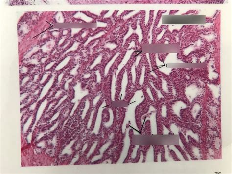 BI 233 LAB Ex 42 Histology of Seminal Vesicles Diagram | Quizlet