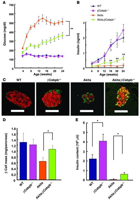 JCI Ablation of C EBPβ alleviates ER stress and pancreatic β cell