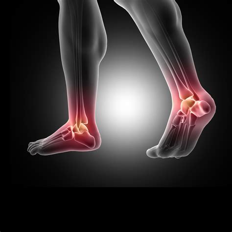 Ankle | Matthew T. Mantell, MD