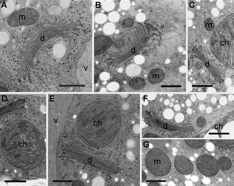 Tem Micrographs Of Organelles In Micrasterias Cells In Controls And Download Scientific Diagram