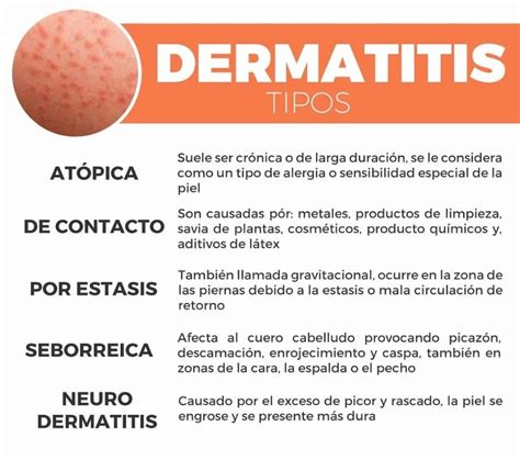 Dermatitis ¿qué Es Causas Síntomas Tratamiento Y Mucho Más