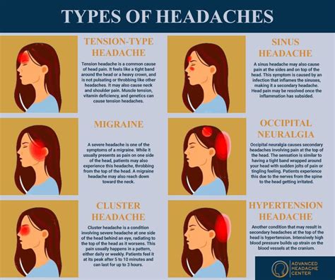 Types Of Headache In Headache Hormonal Headaches Headache Location