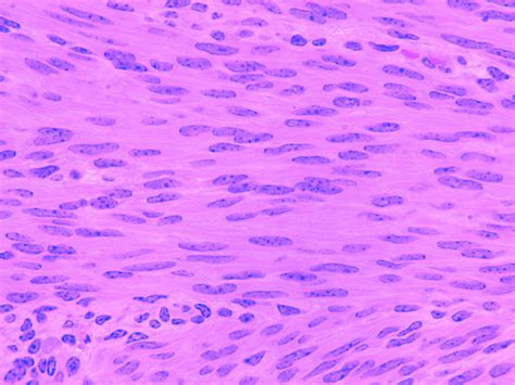 A P Smooth Muscle Tissue Diagram Quizlet