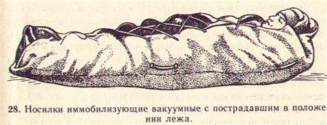 Глава 7 транспортная иммобилизация