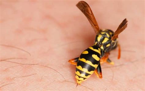 Wasps Sting Miche Pest Control