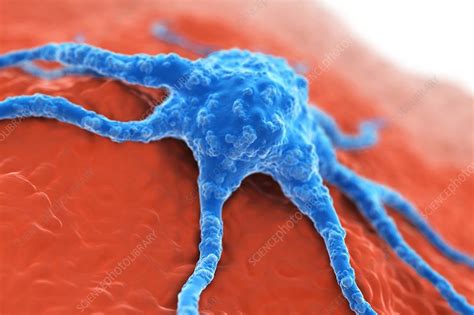 Cancer Cell Artwork Stock Image C020 0731 Science Photo Library