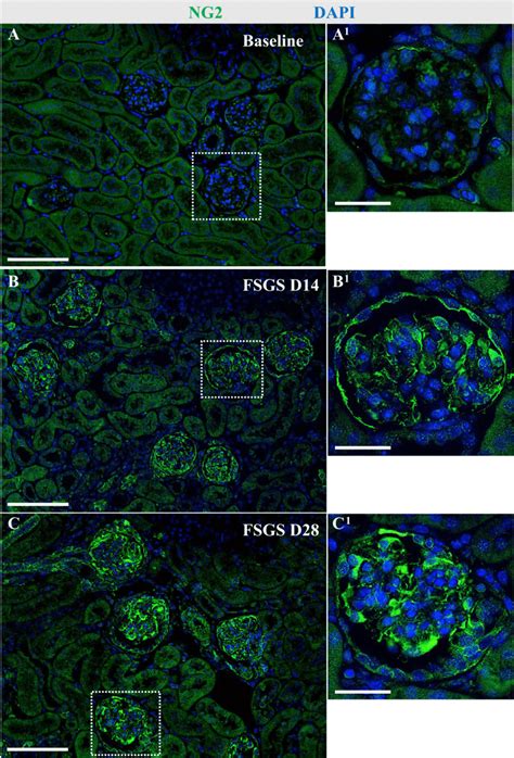 Glomerular Distribution Of Neural Glial Antigen Ng Staining