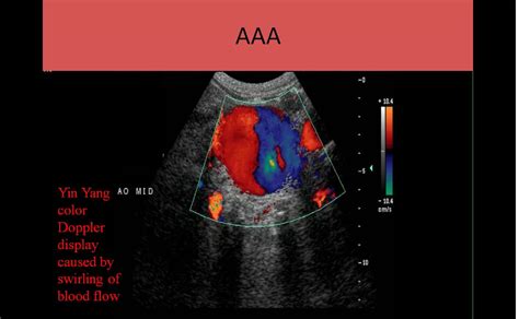 Cci Vascular Ultrasound Registry Review Course