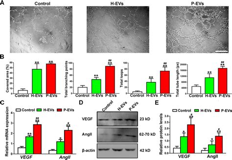 Evs Potentiated The Angiogenic Activities Of Ecs In Vitro A Download Scientific Diagram