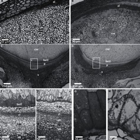 Non Concordant Seed Phenotypes Sagittal Hand Sections Of Mature