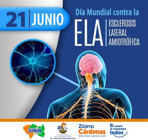 Día Mundial Contra la Esclerosis Lateral Amiotrófica Hospital