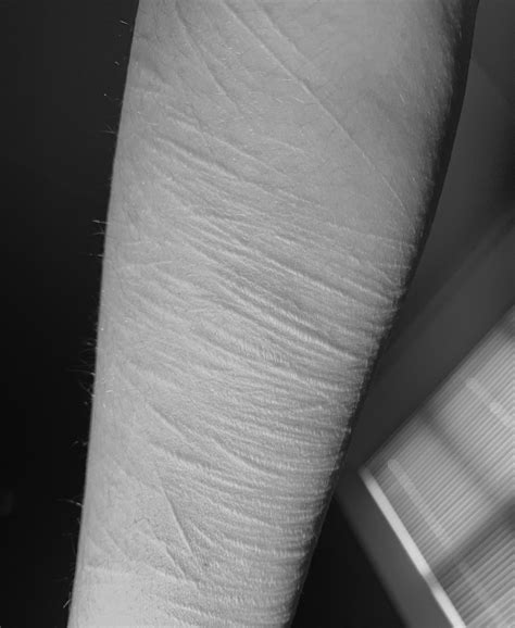 Self Harm Scars Black And White Tumblr Premium Photo | Woman Covered