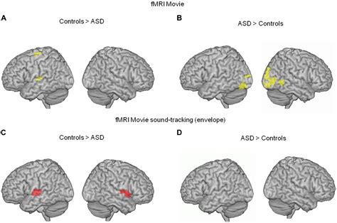 Frontiers Atypical Coordination Of Cortical Oscillations In Response