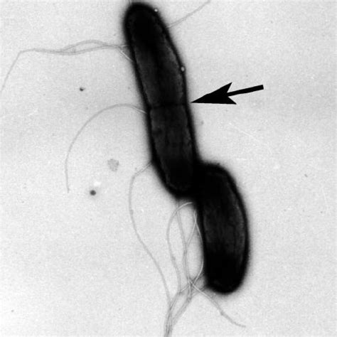 Transmission Electron Micrograph Of Negatively Stained Az Fu T Cells