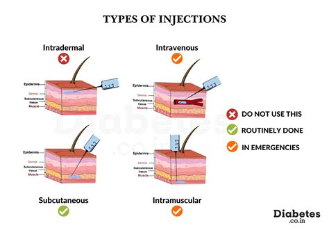 Types Of Insulin Injection