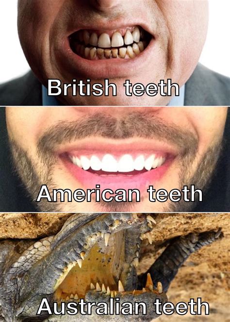 British People Teeth Stereotype