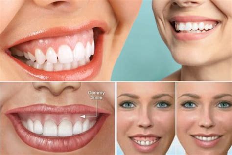 Treatments Estetik İncim Dental Clinic