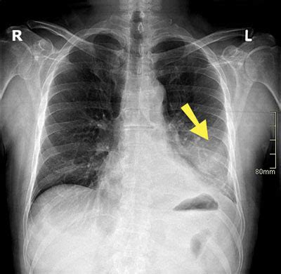 Pneumologische Erkrankungen Marienhospital Stuttgart