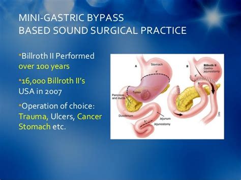 Marginal Ulcer After Gastric Bypass