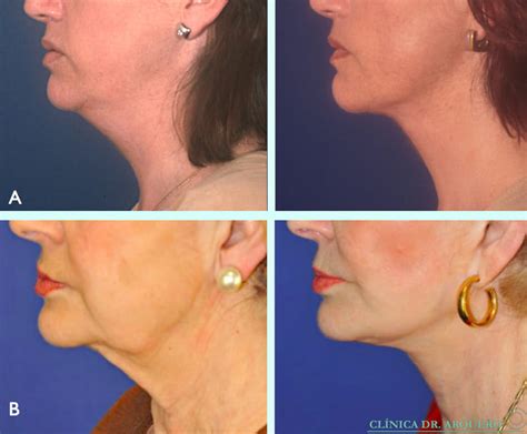 El Cuello Armon A Y Equilibrio C Rvico Facial Cl Nica Arquero