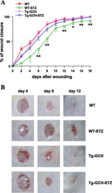 Endothelium Specific GTP Cyclohydrolase I Overexpression Accelerates