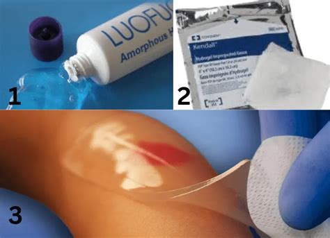 What Is Hydrogel Wound Dressing? See Its 3 Amazing Types! - EcofriendlyHacks