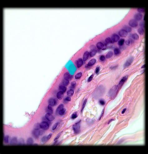 Stratified Cuboidal Epithelium, Transitional Epithelium, and Areolar ...