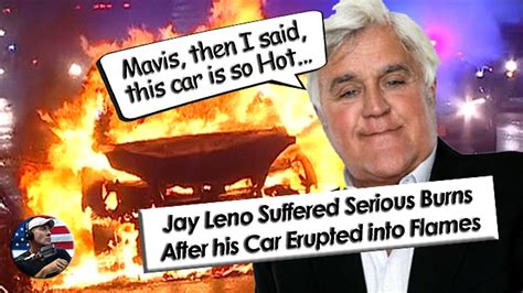 Jay Leno Suffers Serious Facial Burns After One Of His Cars Explodes