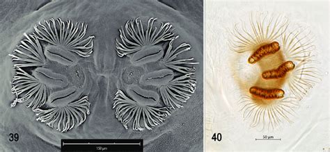 Scanning Electron Photomicrograph And Optical Photomicrograph Of