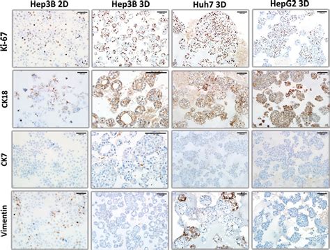 Comparative Immunohistochemical Analysis Of Ki Ck Ck And