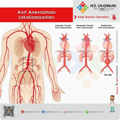 Abdominal Aort Anevrizmasına Acil Yaklaşım Acil Çalışanları